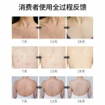 اسپری ضد جوش بدن سیازو رایکو مدل سنتلا آسیتیکا حجم 150 میلی لیتر - Image 2