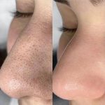 پک کامل پاکسازی فیشال خونگی - Image 3