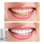 خمیردندان سفیدکننده مارویس Marvis Whitening Mint حجم 85 میلی‌لیتر