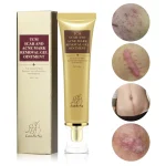 ژل کرم ترمیم کننده جای جوش و اسکار لانبنا (LANBENA) مدل SKIN CARE