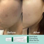سرم ضد لک اکسیس وای مدل Dark Spot حجم ۵۰ میلی‌لیتر - Image 4